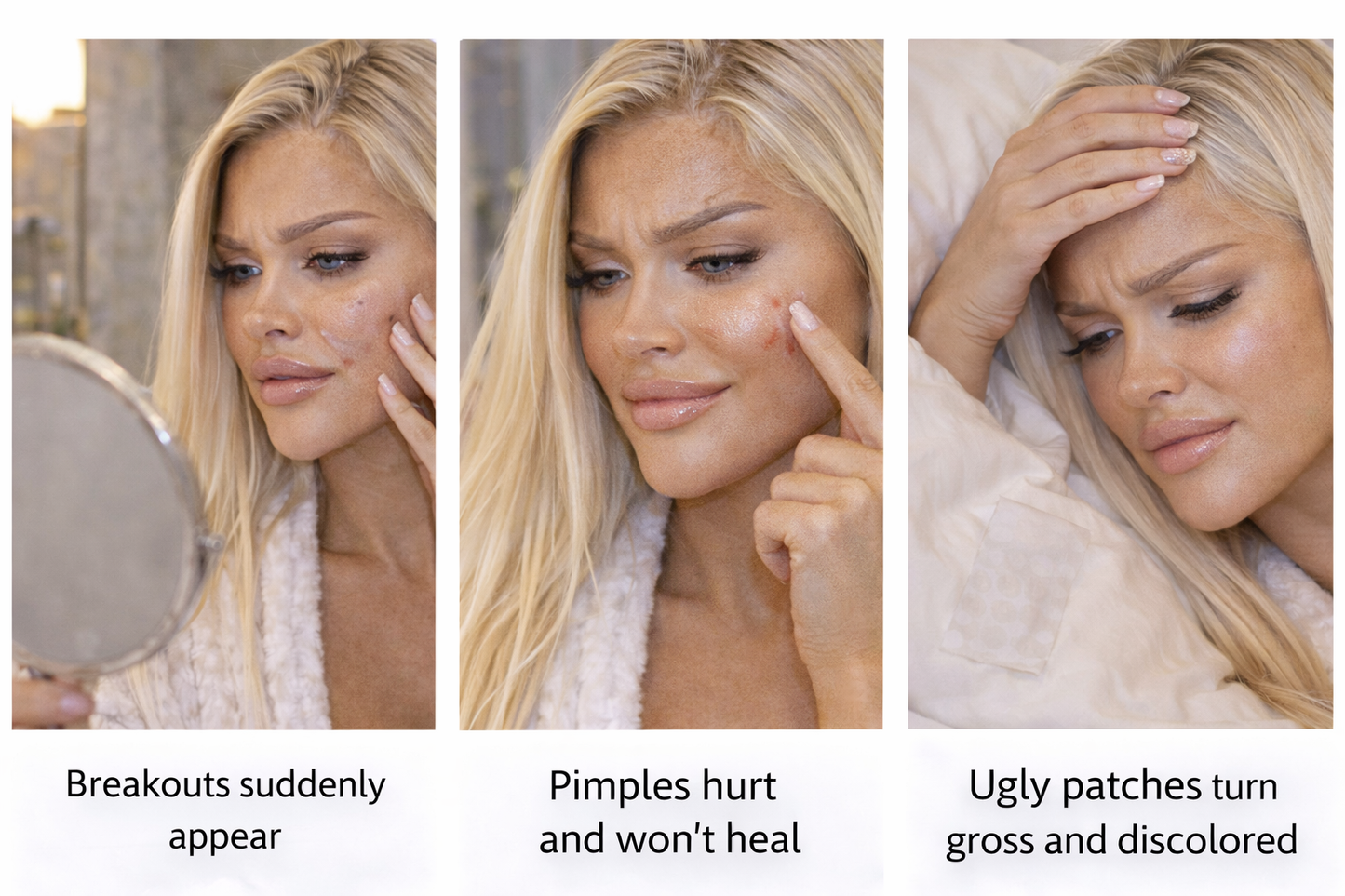 CLEARSKIN™ Invisible Acne Repair Patch – Fast, Clean & Discreet Spot Treatment