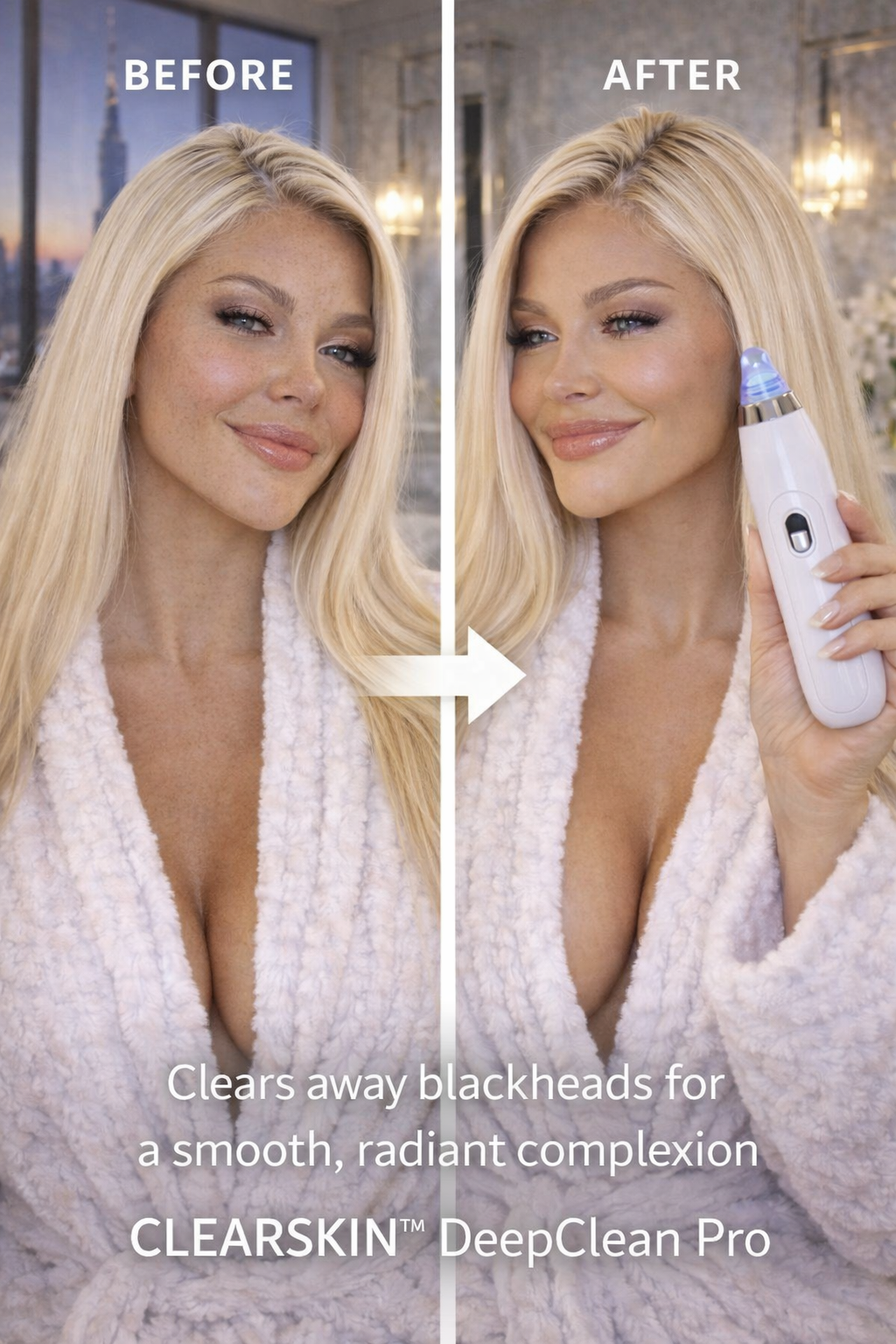 CLEARSKIN™ DeepClean Pro – Professional Blackhead & Acne Pore Vacuum for Clear, Smooth & Glowing Skin