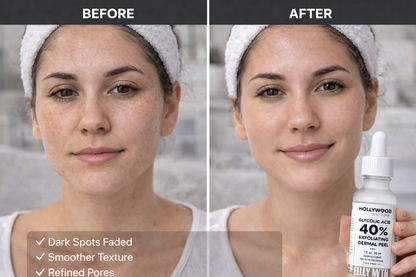 40% Glycolic Acid Resurfacing Peel (1 oz) — Smooth, Brighten & Refine