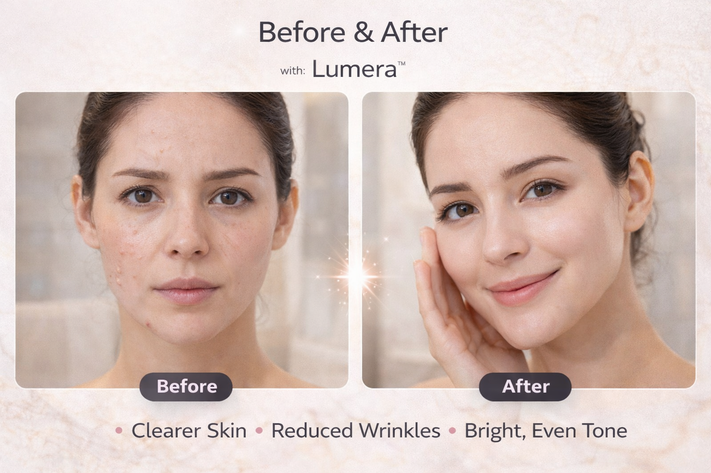 Lumera™ Radiance Mask
