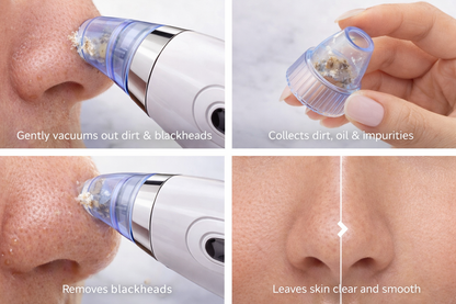CLEARSKIN™ DeepClean Pro – Professional Blackhead & Acne Pore Vacuum for Clear, Smooth & Glowing Skin